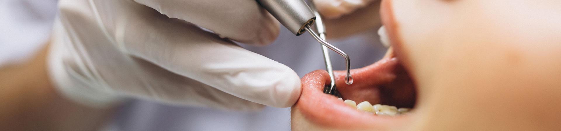 dentist checking a patients teeth